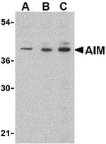 AIM Antibody in Western Blot (WB)