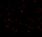 AIM Polyclonal Antibody