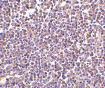 AIM Antibody in Immunohistochemistry (IHC)