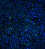 TIMD4 Antibody in Immunohistochemistry (IHC)