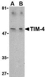TIMD4 Polyclonal Antibody