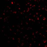 BIK Antibody in Immunocytochemistry (ICC/IF)