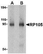 CD180 Antibody in Western Blot (WB)