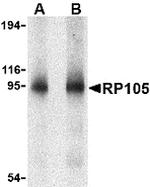 CD180 Antibody in Western Blot (WB)