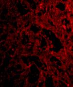 CD180 Antibody in Immunohistochemistry (IHC)