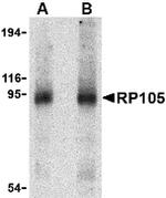CD180 Antibody in Western Blot (WB)