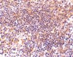 PAK2 Polyclonal Antibody