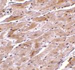 TRPC3 Polyclonal Antibody