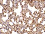 TRPC6 Antibody in Immunohistochemistry (IHC)