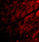 TRPC3 Polyclonal Antibody