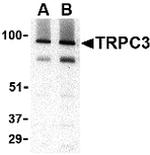 TRPC3 Antibody in Western Blot (WB)