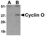 Cyclin O Polyclonal Antibody