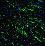 BAG1 Polyclonal Antibody