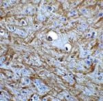 BAG1 Antibody in Immunohistochemistry (IHC)