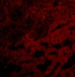 BCL2A1 Antibody in Immunohistochemistry (IHC)