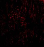 TANK Polyclonal Antibody