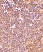 PAK2 Polyclonal Antibody