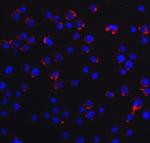 RIG-I Polyclonal Antibody