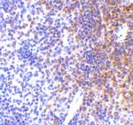 IRF7 Polyclonal Antibody