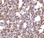 PKR Polyclonal Antibody