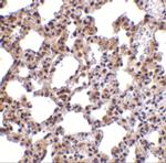 PKR Polyclonal Antibody