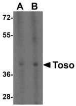 FAIM3 Polyclonal Antibody