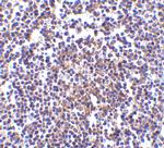 AVEN Antibody in Immunohistochemistry (IHC)