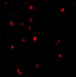 c-Cbl Polyclonal Antibody