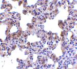 PEN2 Antibody in Immunohistochemistry (IHC)