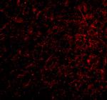 Nicastrin Polyclonal Antibody