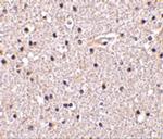 Nicastrin Antibody in Immunohistochemistry (IHC)