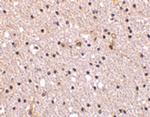Nicastrin Antibody in Immunohistochemistry (IHC)