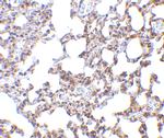 SnoN Antibody in Immunohistochemistry (IHC)