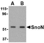 SnoN Antibody in Western Blot (WB)