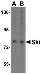 SKI Antibody in Western Blot (WB)