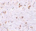 PDCD4 Polyclonal Antibody