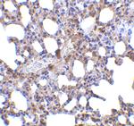 Blimp-1 Polyclonal Antibody