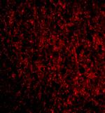 TMP21 Polyclonal Antibody