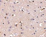 APH1 Polyclonal Antibody