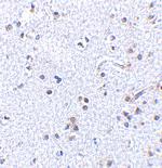 TSLP Polyclonal Antibody
