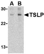 TSLP Antibody in Western Blot (WB)