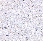 TSLP Antibody in Immunohistochemistry (Paraffin) (IHC (P))