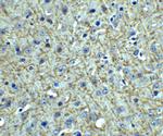 TSLP Polyclonal Antibody