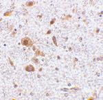 TSLP Polyclonal Antibody