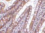 CIDEB Antibody in Immunohistochemistry (IHC)