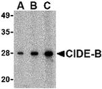 CIDEB Antibody in Western Blot (WB)