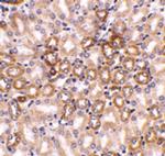 Nephrin Polyclonal Antibody