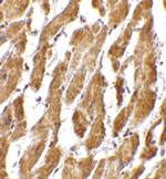 CRTH2 Polyclonal Antibody