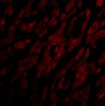 CRTH2 Polyclonal Antibody