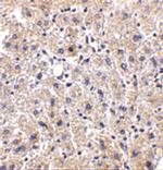 DRAM Polyclonal Antibody